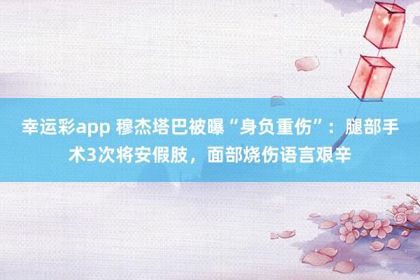 幸运彩app 穆杰塔巴被曝“身负重伤”：腿部手术3次将安假肢，面部烧伤语言艰辛